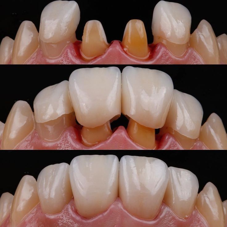 Fotografías de rehabilitación oral